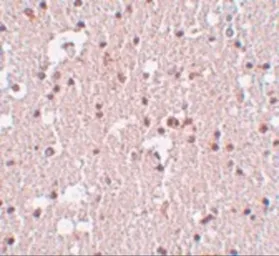 Anti-FRMPD3 antibody used in IHC (Paraffin sections) (IHC-P). GTX85235