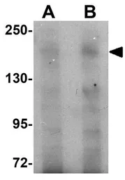 Anti-FRMPD3 antibody used in Western Blot (WB). GTX85235