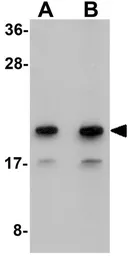 Anti-Mimitin antibody used in Western Blot (WB). GTX85237