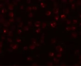 Anti-Mimitin antibody used in Immunocytochemistry/ Immunofluorescence (ICC/IF). GTX85237