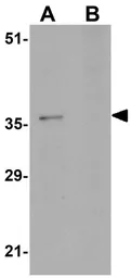 Anti-PA1 antibody used in Western Blot (WB). GTX85239