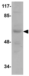 Anti-INSM1 antibody used in Western Blot (WB). GTX85243