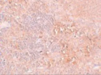 Anti-JMJD4 antibody used in IHC (Paraffin sections) (IHC-P). GTX85252