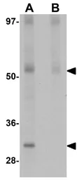 Anti-JMJD4 antibody used in Western Blot (WB). GTX85252
