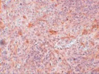 Anti-ABIN3 antibody used in IHC (Paraffin sections) (IHC-P). GTX85255