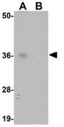 Anti-ABIN3 antibody used in Western Blot (WB). GTX85255