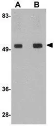 Anti-TMEM214 antibody used in Western Blot (WB). GTX85256