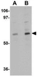 Anti-TMEM214 antibody used in Western Blot (WB). GTX85257