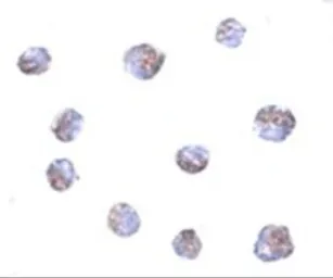 Anti-TMEM214 antibody used in Immunocytochemistry/ Immunofluorescence (ICC/IF). GTX85257
