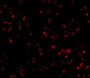 Anti-TMEM214 antibody used in Immunocytochemistry/ Immunofluorescence (ICC/IF). GTX85257