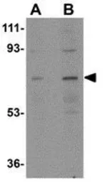 Anti-NOTUM antibody used in Western Blot (WB). GTX85260