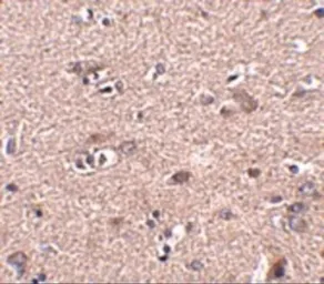 Anti-SCAMP4 antibody used in IHC (Paraffin sections) (IHC-P). GTX85261