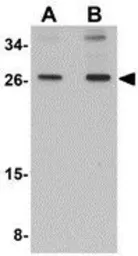Anti-SCAMP4 antibody used in Western Blot (WB). GTX85261