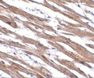 Anti-MAK10 antibody used in IHC (Paraffin sections) (IHC-P). GTX85265