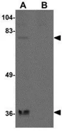 Anti-MAK10 antibody used in Western Blot (WB). GTX85265