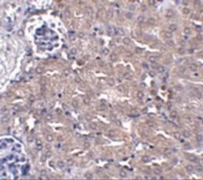 Anti-Ubiquilin 4 antibody used in IHC (Paraffin sections) (IHC-P). GTX85267