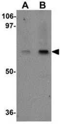 Anti-Ubiquilin 4 antibody used in Western Blot (WB). GTX85267