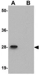 Anti-LIAR antibody used in Western Blot (WB). GTX85269