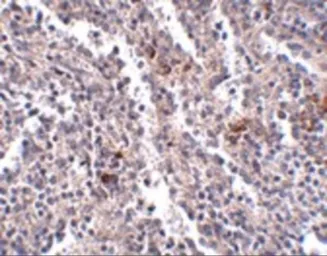 Anti-SYPL2 antibody used in IHC (Paraffin sections) (IHC-P). GTX85272