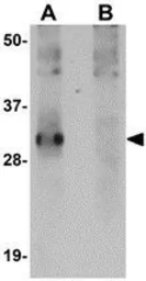 Anti-SYPL2 antibody used in Western Blot (WB). GTX85272