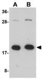 Anti-ZCRB1 antibody used in Western Blot (WB). GTX85274