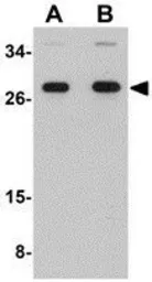 Anti-PNAS4 antibody used in Western Blot (WB). GTX85277