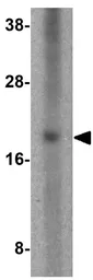 Anti-UCMA antibody used in Western Blot (WB). GTX85279