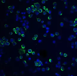Anti-RGS21 antibody used in Immunocytochemistry/ Immunofluorescence (ICC/IF). GTX85280