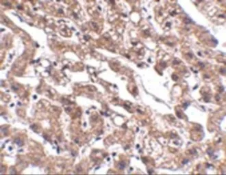 Anti-MACC1 antibody used in IHC (Paraffin sections) (IHC-P). GTX85281