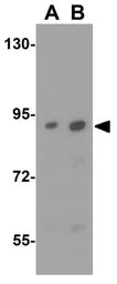 Anti-MACC1 antibody used in Western Blot (WB). GTX85281