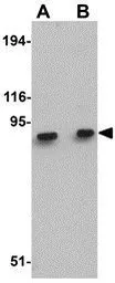 Anti-MACC1 antibody used in Western Blot (WB). GTX85281