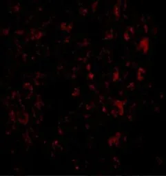 Anti-MACC1 antibody used in IHC (Paraffin sections) (IHC-P). GTX85281