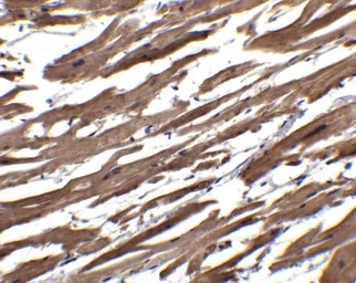 Anti-RSPO1 antibody used in IHC (Paraffin sections) (IHC-P). GTX85282
