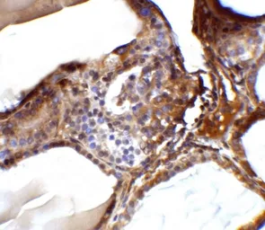 Anti-RSPO1 antibody used in IHC (Paraffin sections) (IHC-P). GTX85282