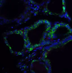 Anti-RSPO1 antibody used in IHC (Paraffin sections) (IHC-P). GTX85282