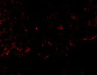Anti-RSPO1 antibody used in IHC (Paraffin sections) (IHC-P). GTX85282