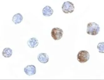 Anti-ST3gal6 antibody used in Immunocytochemistry/ Immunofluorescence (ICC/IF). GTX85283