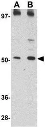 Anti-MATN3 antibody used in Western Blot (WB). GTX85288