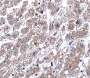 Anti-MATN1 antibody used in IHC (Paraffin sections) (IHC-P). GTX85289