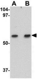 Anti-MATN1 antibody used in Western Blot (WB). GTX85289