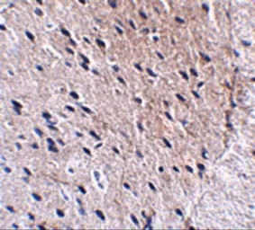 Anti-Bora antibody used in IHC (Paraffin sections) (IHC-P). GTX85293