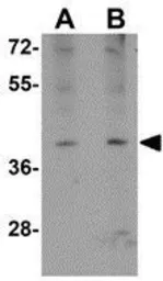 Anti-ATOH8 antibody used in Western Blot (WB). GTX85296