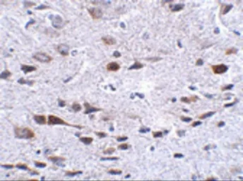 Anti-Bora antibody used in IHC (Paraffin sections) (IHC-P). GTX85297
