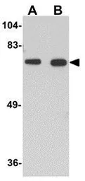 Anti-Bora antibody used in Western Blot (WB). GTX85297