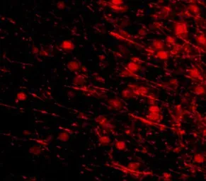Anti-LRFN4 antibody used in IHC (Paraffin sections) (IHC-P). GTX85341