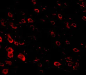 Anti-LRFN3 antibody used in IHC (Paraffin sections) (IHC-P). GTX85343