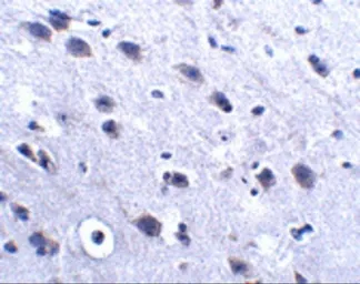Anti-LRFN2 antibody used in IHC (Paraffin sections) (IHC-P). GTX85344