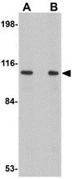 Anti-LRFN2 antibody used in Western Blot (WB). GTX85344