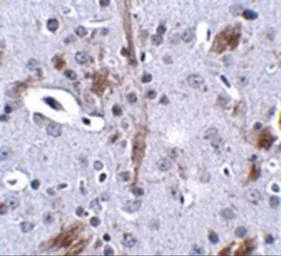 Anti-TTBK1 antibody used in IHC (Paraffin sections) (IHC-P). GTX85349