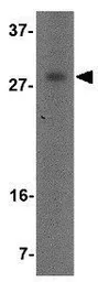 Anti-OCC1 antibody used in Western Blot (WB). GTX85350